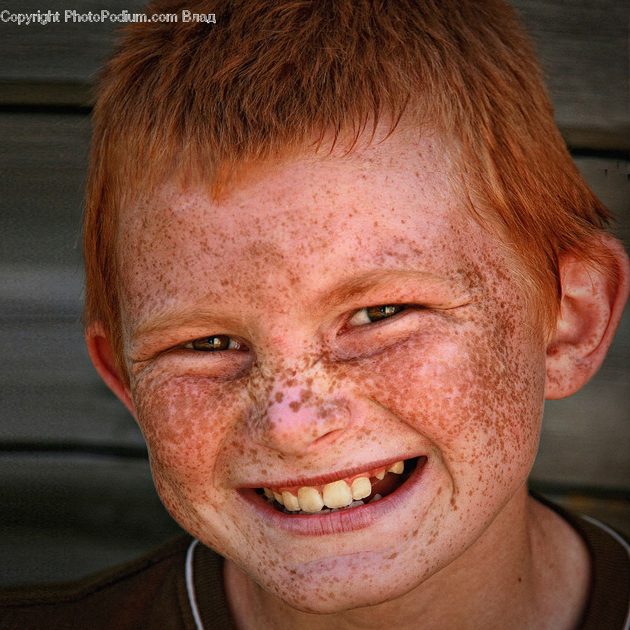Human, People, Person, Face, Freckle, Skin, Dimples