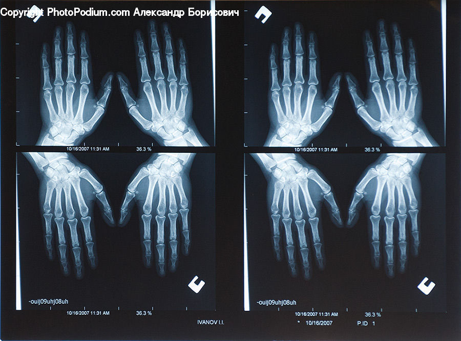 Ct Scan, X-Ray, Flyer, Poster, Paper, Collage, Emblem