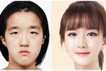 selena Parker : Best in Cosmetic Surgery in Seoul Korea 